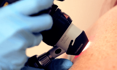 Diagnostic methods of planar wart