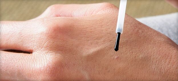 drug treatment of warts